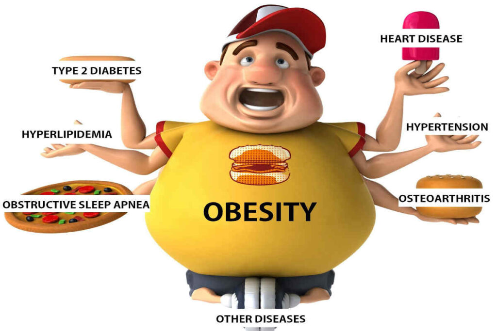 Obesity graphic